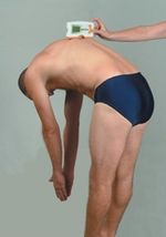 Scoliosis